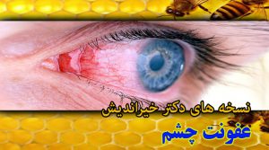 درمان عفونت چشم با عسل